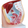 Modelo de seção da pelve feminina